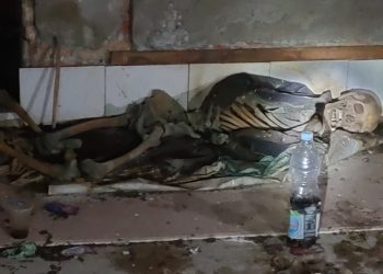 Warga Siantar State Geger, Ada Penemuan Tengkorak Manusia di Rumah Kosong